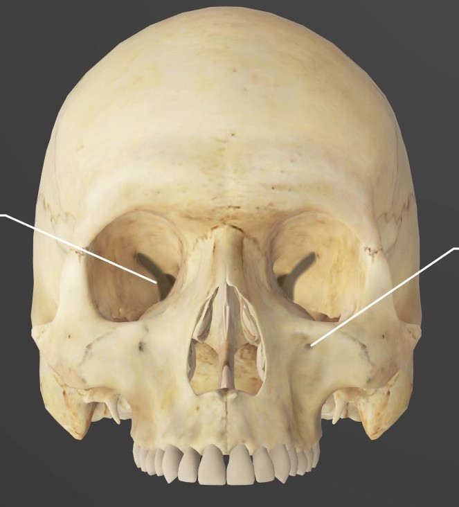 <p>Narrow slit opening</p>