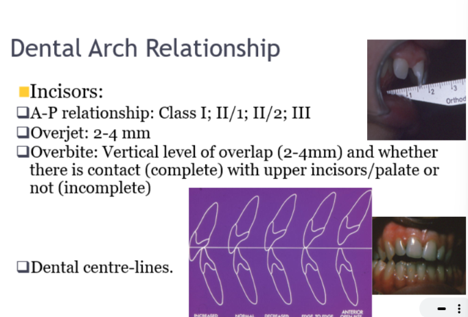 <ul><li><p>After classification</p></li><li><p>overjet - AP measurement distance between labial surface of lower incisors and incisal edge of upper incisors</p></li><li><p>Overbite - overlap between upper and lower incisors</p></li></ul><p></p>
