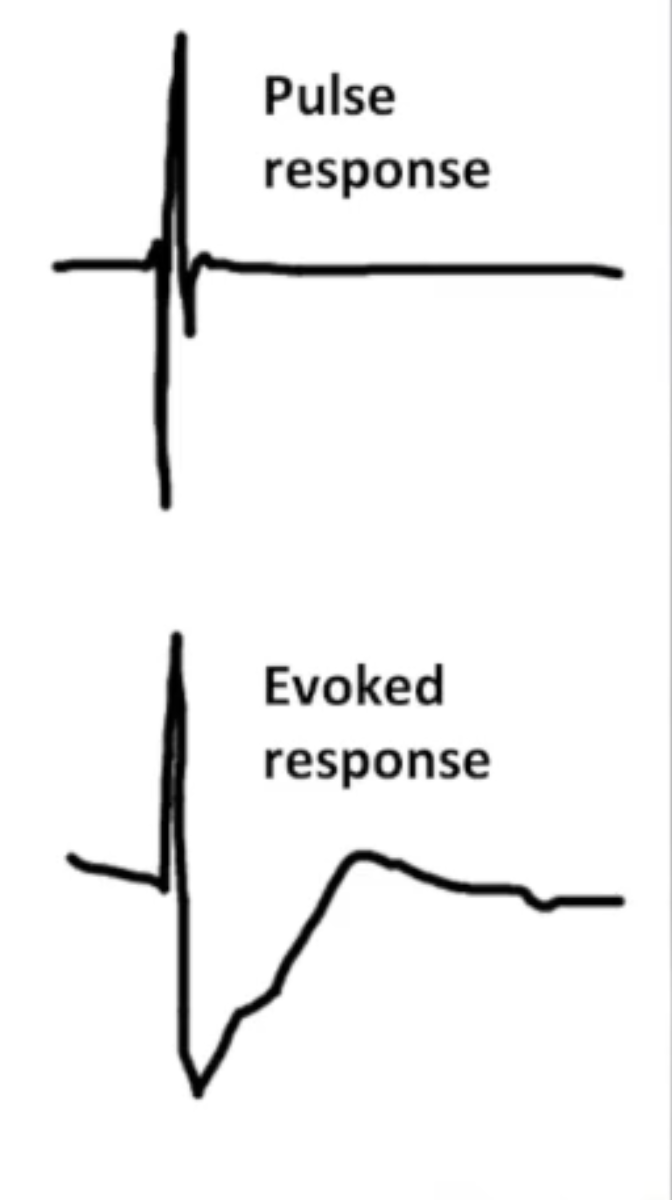 <p>Automatically tests thresholds and resets outputs</p><ul><li><p>Pulse response (PR)</p><ul><li><p>Traditional sensing amplifier</p></li><li><p>Used to sense intrinsic R waves</p></li></ul></li><li><p>Evoked response (ER)</p><ul><li><p>New sensing amplifier for autocapture</p></li><li><p>Electric potential recorded following pacing stimulus</p></li><li><p>Morphology changes when capture is lost</p></li></ul></li></ul><p></p>