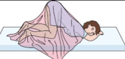 <p>Knee-chest (Knee-elbow)</p>