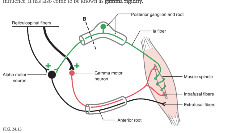 <p><span>The extensor hypertonus observed in decerebrate individuals could be the result of excessive activation of either alpha or gamma motor neurons. To answer this question, the posterior root input from one extremity was interrupted in a decerebrate animal ( </span>Figs. 24.9A, B <span>, </span>24.10A, B <span>, and </span>24.13 <span>). Immediately, the extensor hypertonus in that limb collapsed. This suggests that the descending reticulospinal or vestibulospinal influence on extensor motor neurons is focused primarily on </span><strong>gamma </strong><span>rather than on </span><strong>alpha </strong><span>extensor motor neurons ( </span>Fig. 24.13 <span>). Lesioning of the posterior root would not affect the integrity of the descending reticulospinal or vestibulospinal projections onto alpha motor neurons. However, sectioning of the posterior root interrupts the gamma loop and thus eliminates the circuit that would be used by the gamma motor neuron to produce indirect activation of extensor alpha motor neurons (via activation of Ia sensory fibers) and subsequently the stimulation of extensor extrafusal muscle fibers ( </span>Fig. 24.13 <span>). Thus, because decerebrate rigidity is associated with loss of the gamma motor neuron influence, it has also come to be known as </span><strong>gamma rigidity.</strong></p><p></p><p>The gamma loop is formed by (1) gamma motor neurons that innervate intrafusal muscle fibers; (2) intrafusal muscle fibers that contract, stretching the sensory terminal encircling the central region of the spindle with consequent activation of the Ia fiber; (3) Ia fibers entering the posterior root and activating alpha motor neurons in the anterior horn; and (4) increased Ia activity, causing increased alpha motor neuron activity with consequent extrafusal muscle contraction. Sectioning of the posterior root ( <em>broken line, B </em>) removes the Ia fiber, and gamma motor neurons no longer “indirectly” produce contraction of extrafusal muscle fibers; the gamma loop is interrupted.</p><p></p><p>Other studies aimed at evaluating the role of the vestibulospinal system in the extensor hypertonus involved removal of the anterior lobe of the cerebellar cortex ( Fig. 24.9A, B, C and 24.10A, B, C ). The net effect of the cerebellar cortex (inhibitory Purkinje cell influence on vestibular nuclei and inhibitory Purkinje cell influence on fastigial nucleus activation of vestibulospinal system) on the vestibulospinal system is inhibitory, thus removal of this influence is overall excitatory on vestibulospinal systems. Under these conditions, the extensor hypertonus was increased compared to decerebration alone, and further, this hypertonus remained when the posterior root was subsequently lesioned. This suggests that the hypertonus in that limb is not due to enhanced excitatory input to gamma motor neurons from the gamma loop, but instead there is enhanced direct input to extensor <strong>alpha </strong>motor neurons resulting from increased excitatory activity in the vestibulospinal system.</p>
