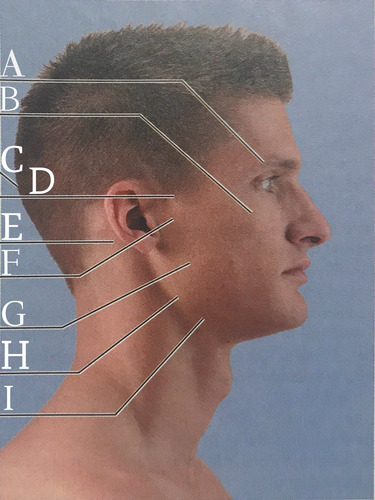 <p>B.</p><p>Cheekbone</p>
