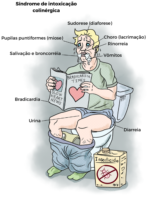 <p><strong><mark data-color="blue" style="background-color: blue; color: inherit;">"Síndrome do homem molhado"</mark></strong></p><p><strong>.</strong></p><p><em>Mnemônico </em><span style="color: blue;"><strong><em>D.U.M.B.B.B.E.L.S</em></strong></span><em>:</em></p><ul><li><p><strong>Defecação</strong></p></li><li><p><strong>Urina</strong></p></li><li><p><strong>Miose</strong></p></li><li><p>BBB → <strong>Bradicardia, Broncorreia, Broncoespasmo</strong></p></li><li><p><strong>Êmese</strong></p></li><li><p><strong>Lacrimejamento</strong></p></li><li><p><strong>Salivação</strong></p></li></ul><p></p>