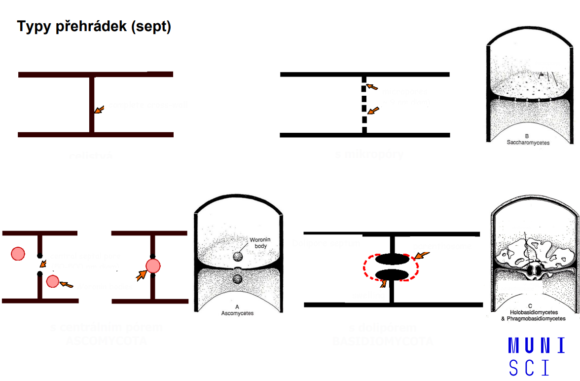 <p>typy přehrádek (sept)</p>