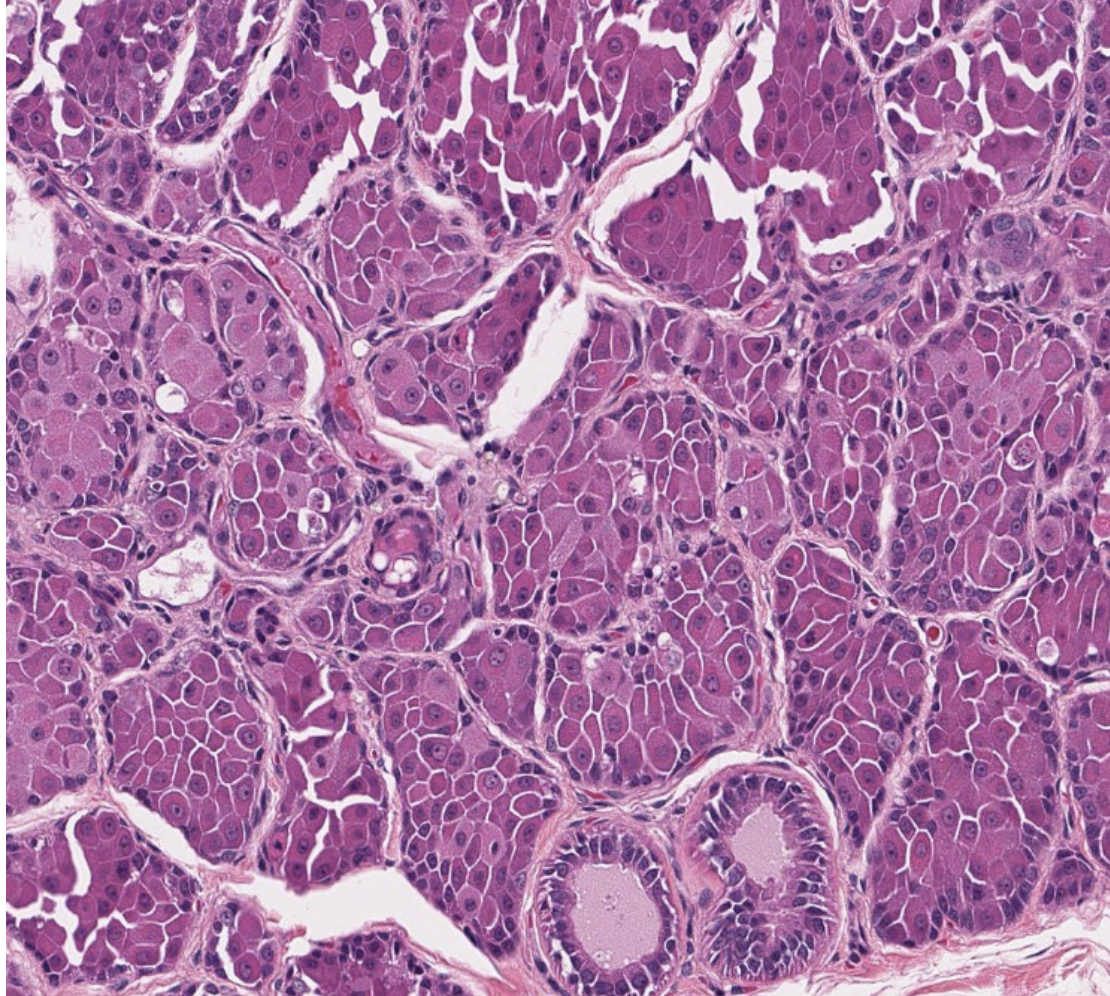 <p>What gland is this?</p>