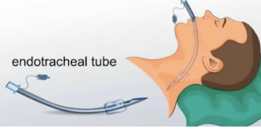 <p>Endotracheal tube indications</p>