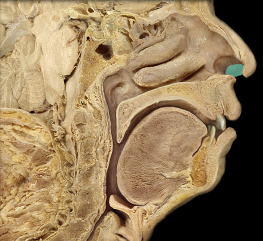 <p>Identify the feature of the nasal cavity</p>