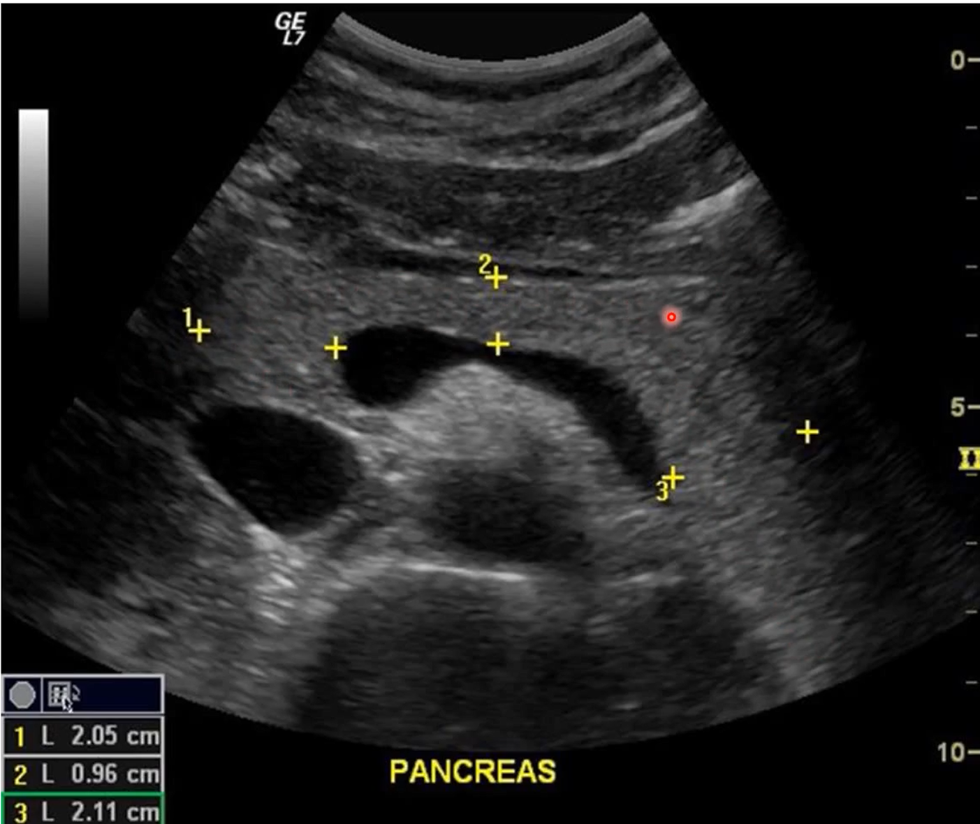 <p>Which areas of the pancreas are which number</p>