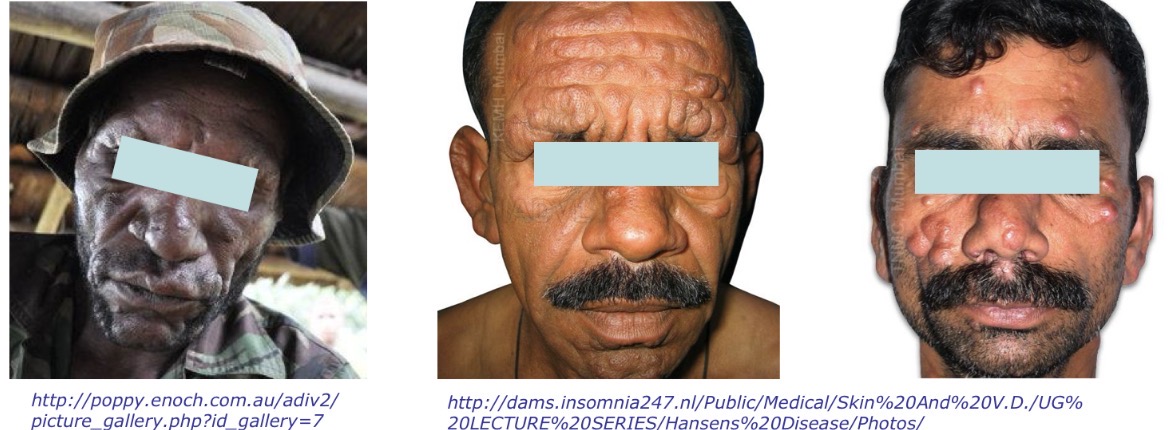 term image