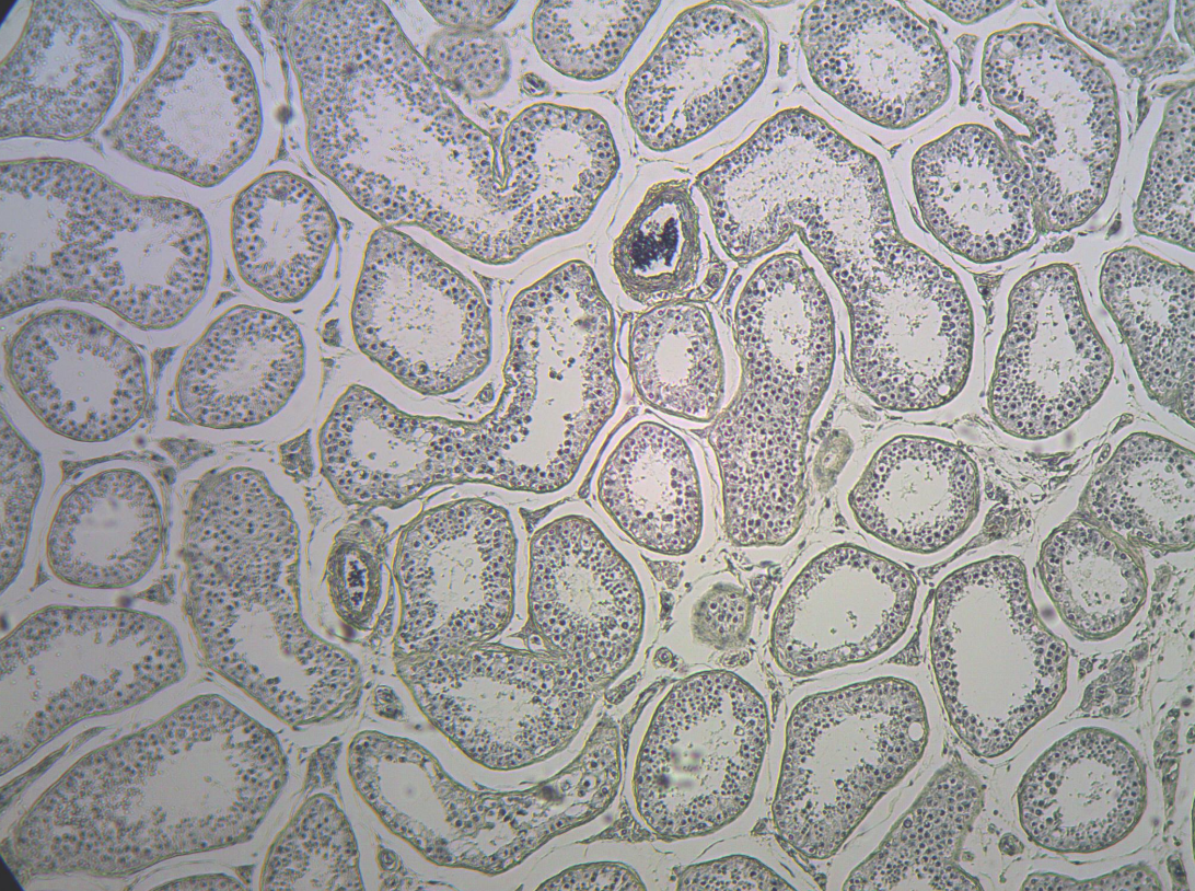 <p>What part of the body is seen in this image?</p>