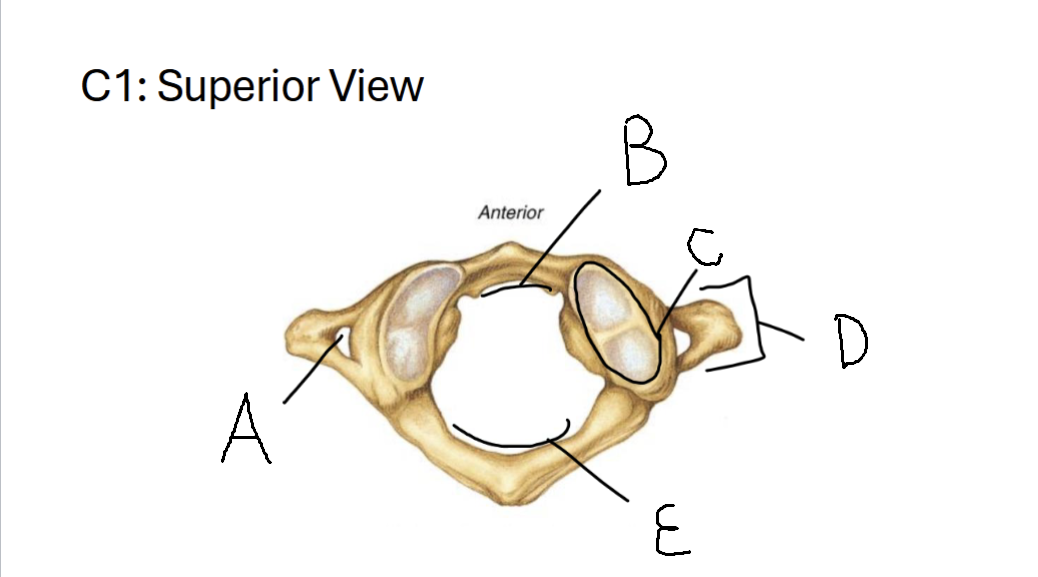 <p>E</p>
