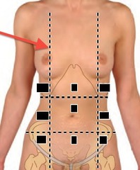 <p>vertical line through the center of each clavicle</p>