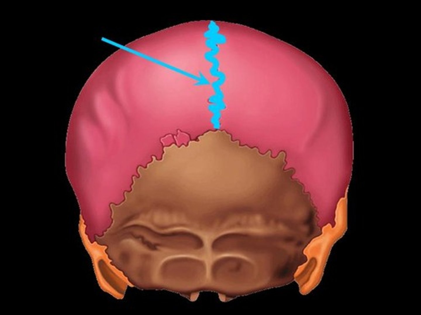 <p>the suture between the right and left parietal bones</p>