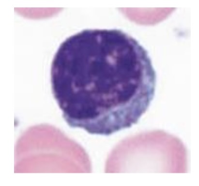 <p>What WBC is this </p>