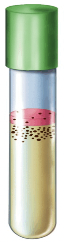 <p>Bacteria that are _______________ require a SMALL amount of oxygen for growth and will only grow at the bottom of the blue layer.</p>