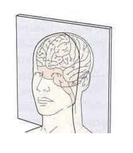 <p>Cut orientation?</p>