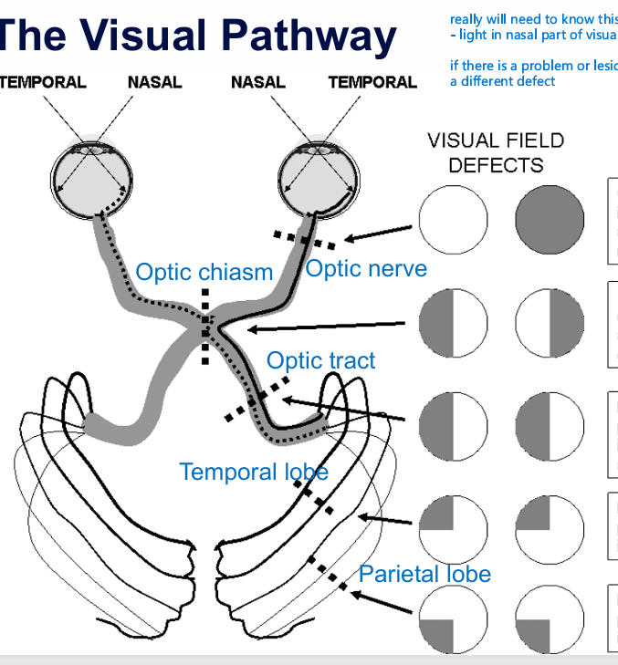 <p>Depending on the test and stuff, and failed, then did SAP to investigete. Good chance you could trace it back to part in the visual pathway depending on where the defect is! </p>