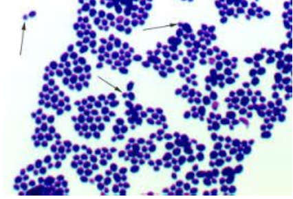 <p><em>Candida albicans</em></p>