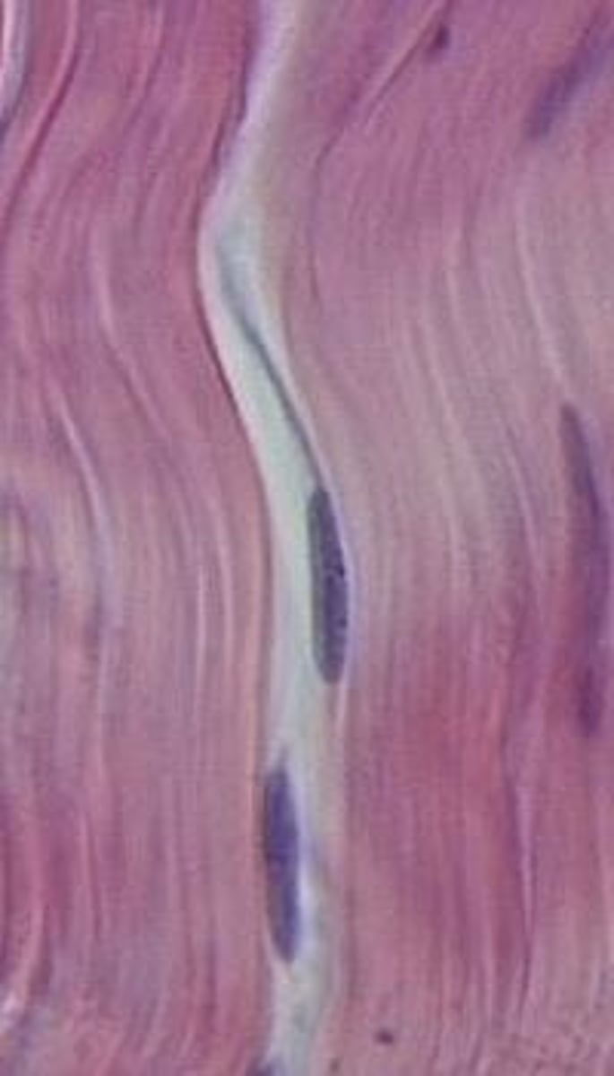 <p>Dense Regular Connective Tissue</p>