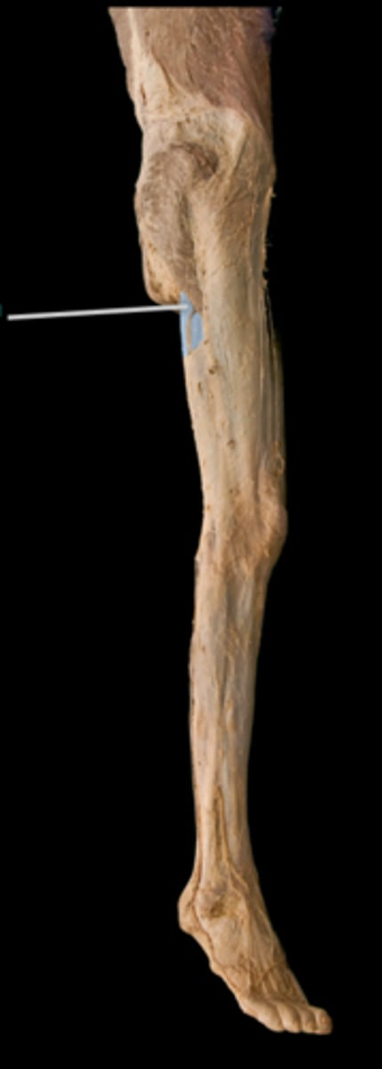 <p>What muscle is this?</p>
