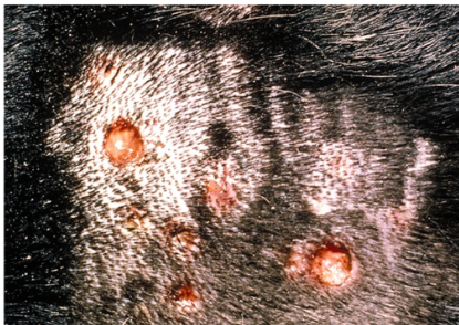 <ul><li><p>type III hypersensitivity vasculitis (e.g. due to drug reaction)</p></li></ul><p></p>