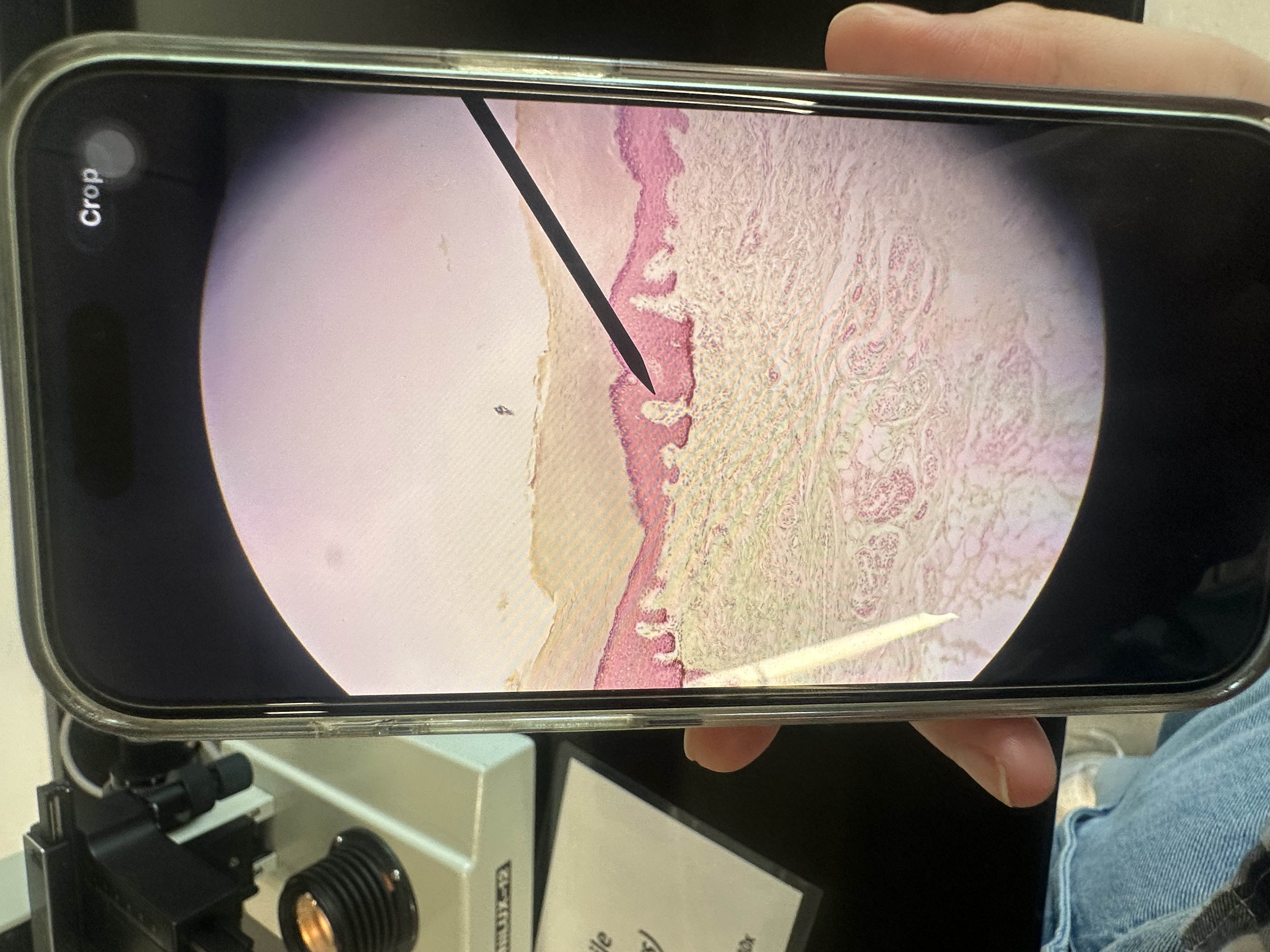 <p>tactile corpuscles </p>
