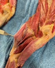 <p>Identify the muscle</p>
