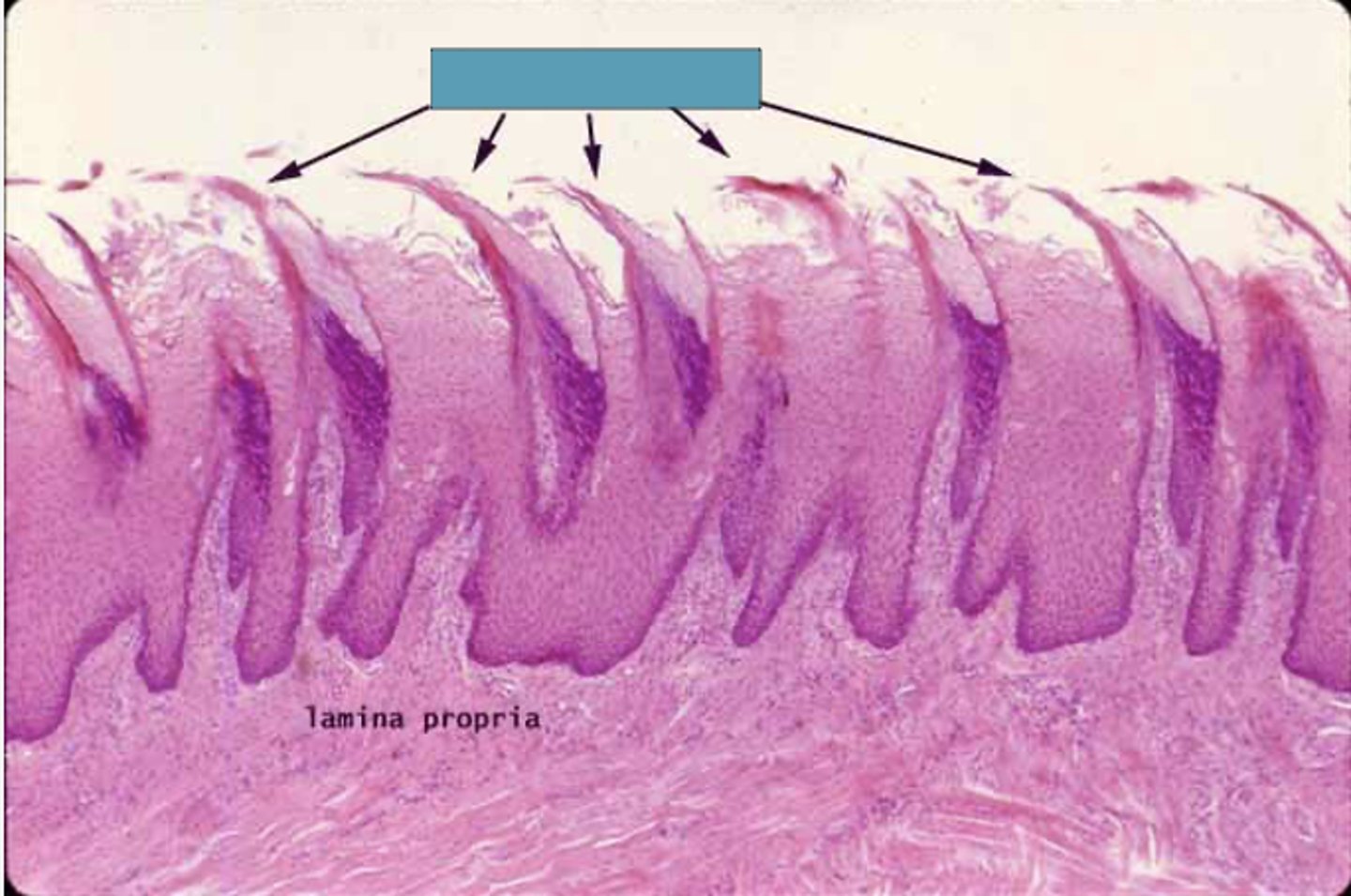 <p>Identify the following structure</p>
