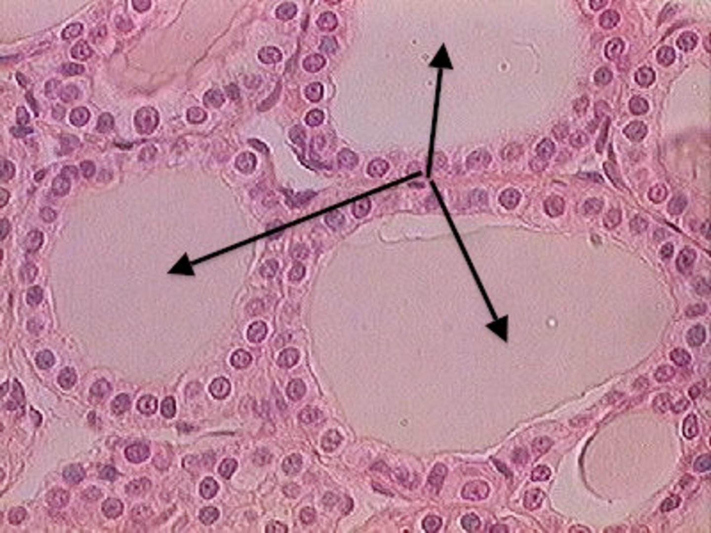 <p>clusters of cells surrounding a single egg</p>