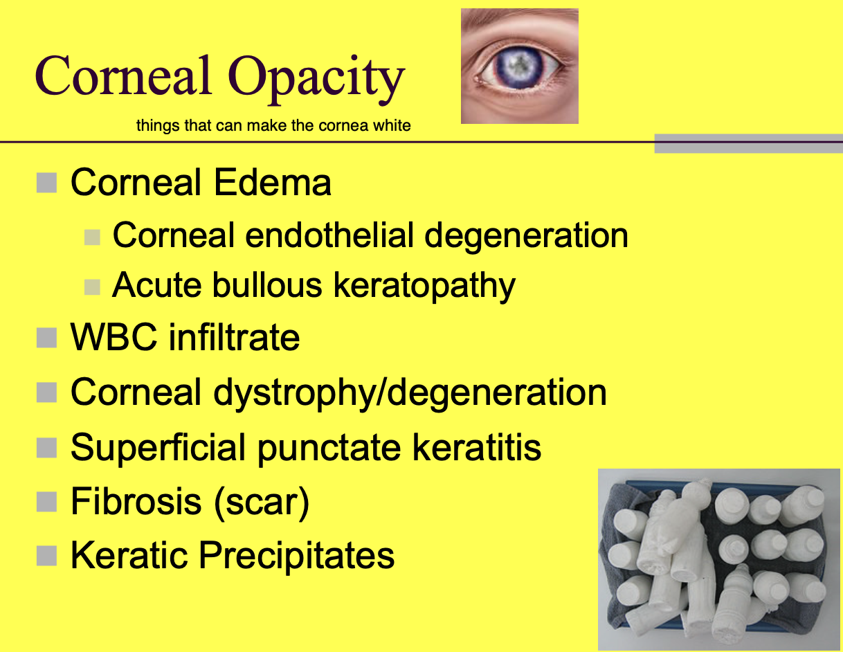 <p>corneal edema - blue (corneal endothelial degeneration, acute bollous keratopathy)</p><p>WBC infiltrates - white.</p><p>Corneal dystrophy/degeneration.</p><p>Superficial punctate keratitis.</p><p>Fibrosis (scar).</p><p>Keratic precipitate.</p>