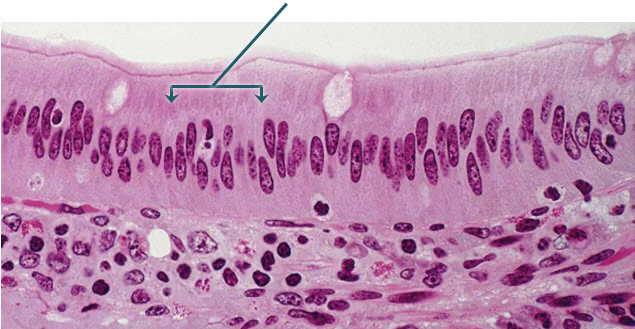 <p>identify the epithelium indicated by the arrows </p>