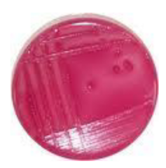 <p>What makes MacConkey agar selective for enteric organisms?</p>
