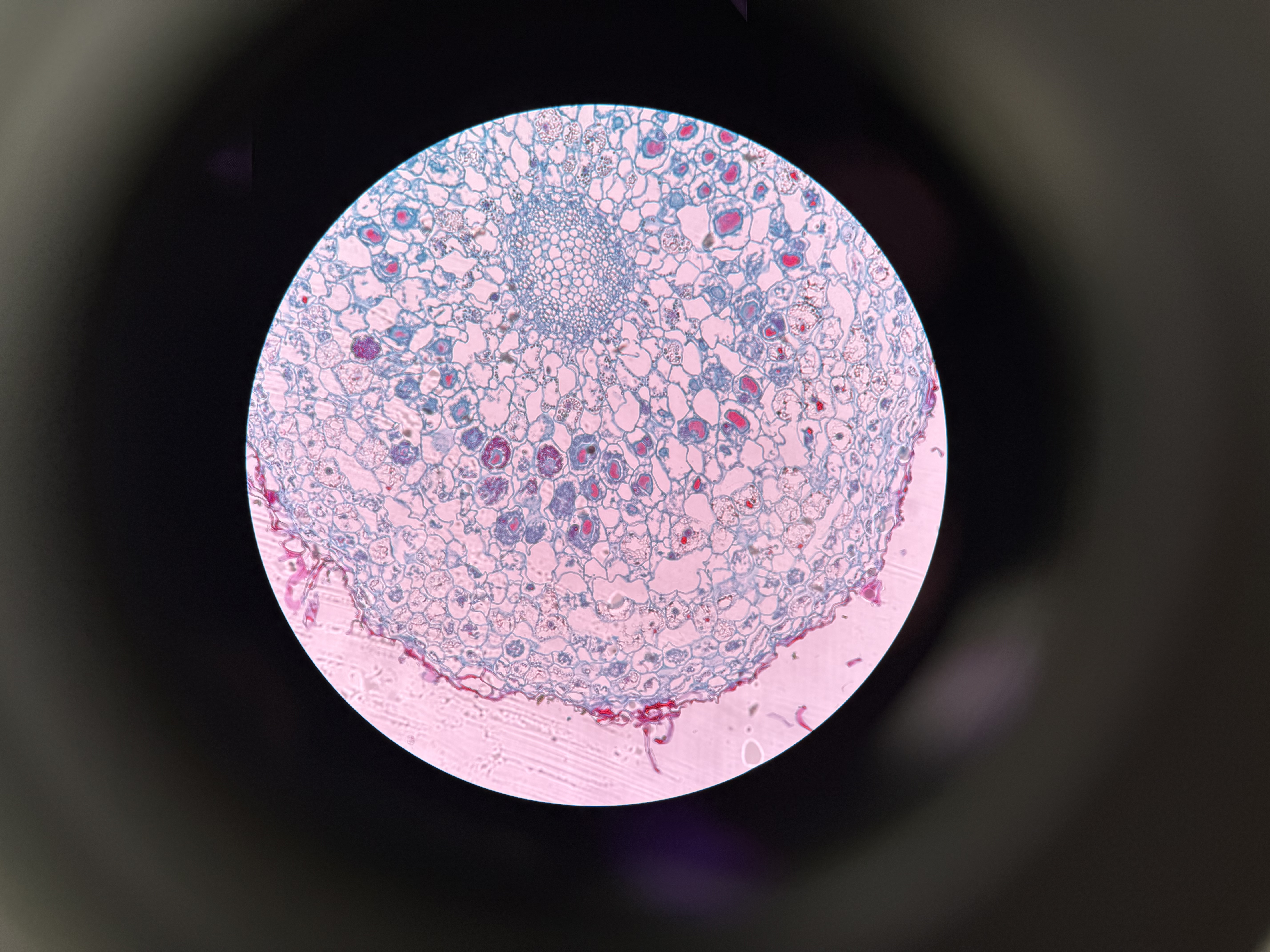 <ol><li><p>What is this?</p></li><li><p>What phylum?</p></li><li><p>Spore location?</p></li><li><p>Is this an endomycorrhizae or an ectomycorrhizae? </p></li></ol><p></p>