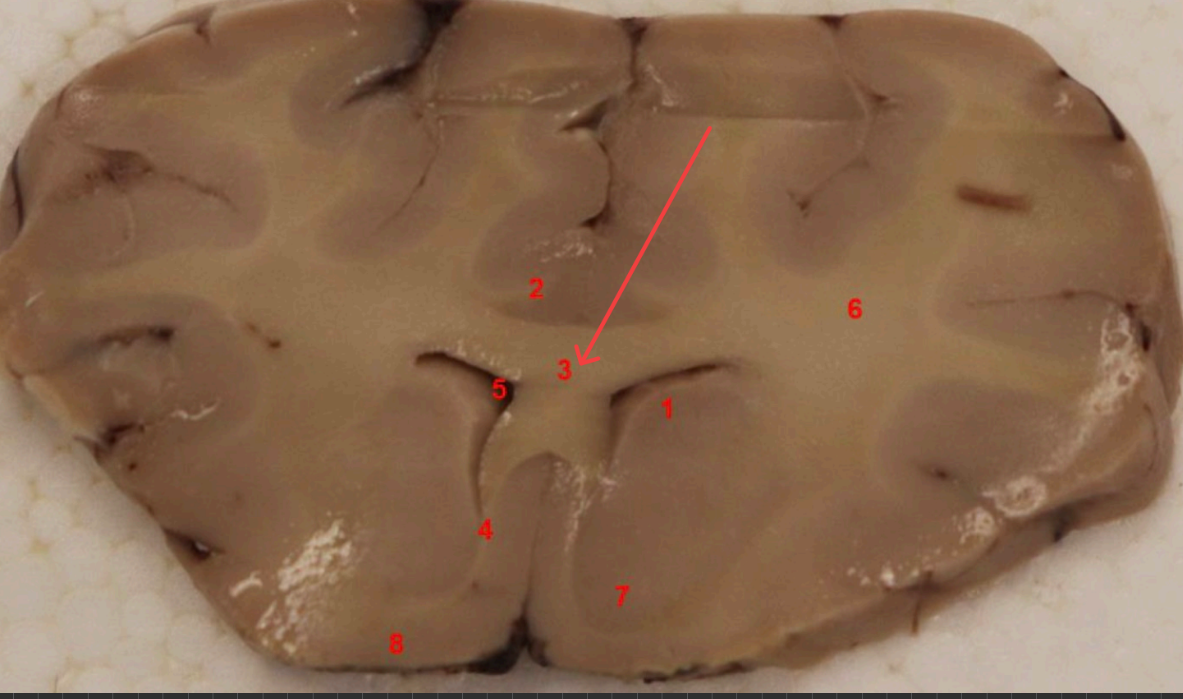 <p>what COMMISSURE i s this </p>