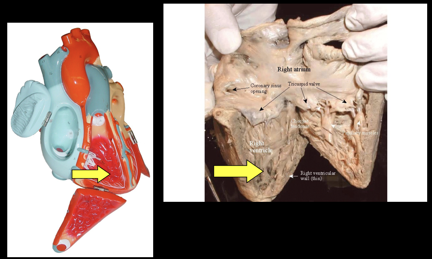 <p>what part of the sheep heart is shown?</p>