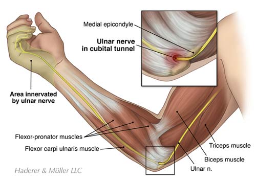 <p>Brachial Plexus Injuries - <strong>Ulnar nerve AKA _____ “bone”</strong></p>