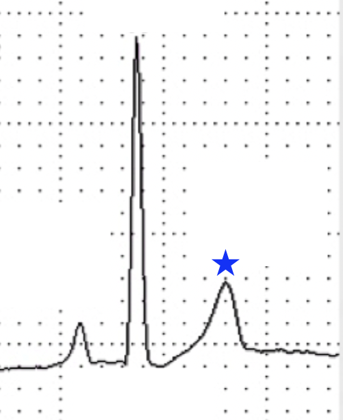 <p>What wave is indicated by the blue star?</p>
