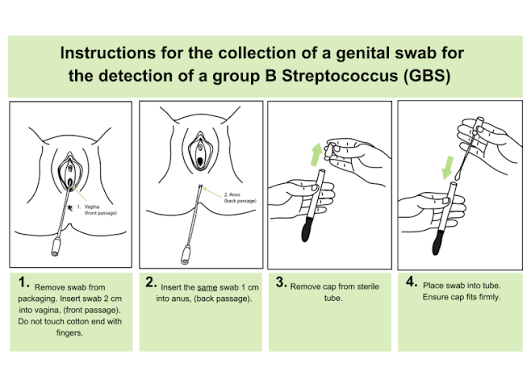 <p>Take 1 sterile swap and insert it 2cm into the vaginal and then use the same swab and insert it 1 cm into the anus.</p><p></p><p>At 35-37 weeks </p>