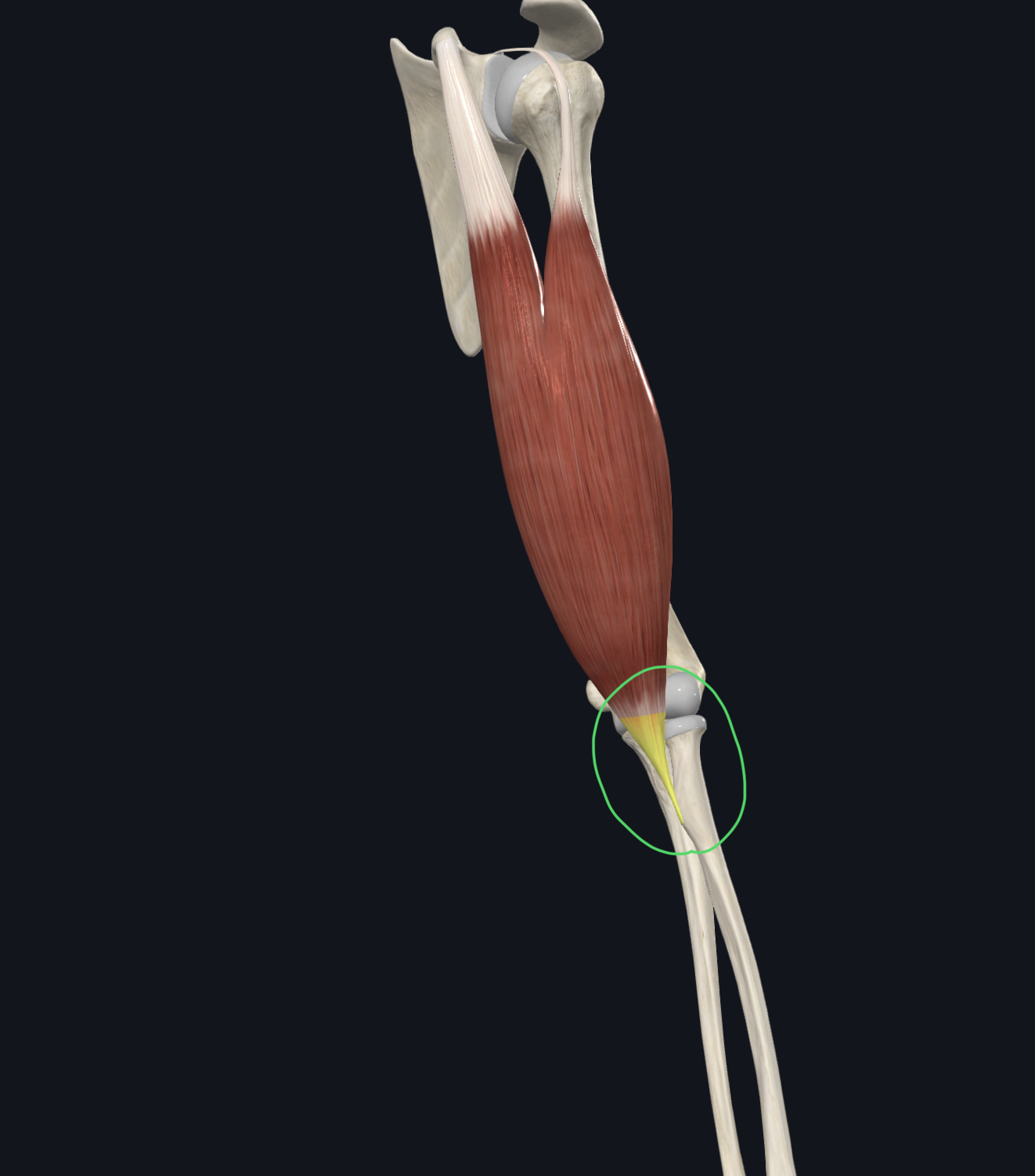 <p>Radial tuberosity</p>