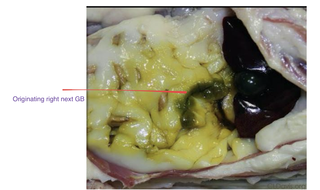 <p>describe bile inhibition </p>