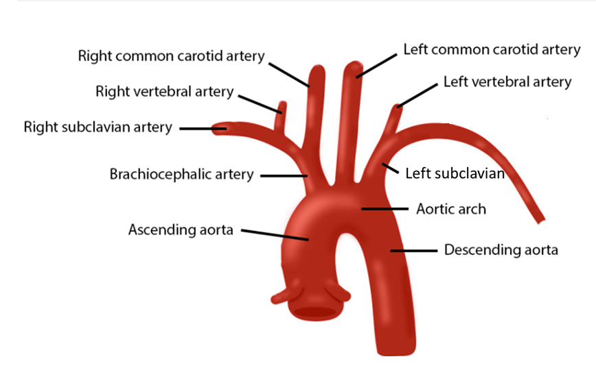 <p>3 branches of aortic arch</p>