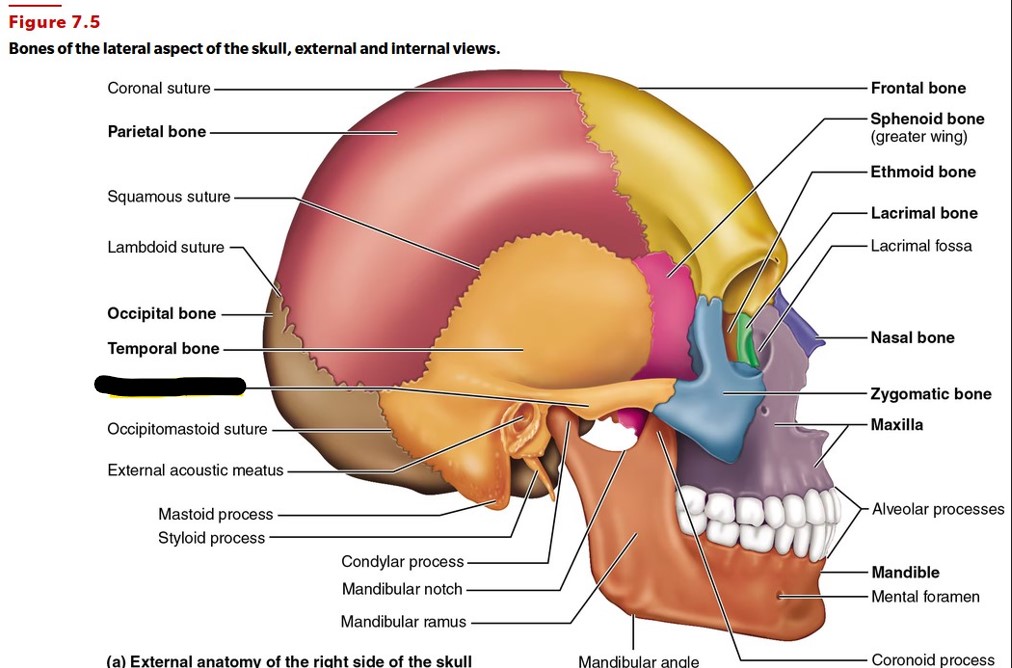 <p>Identify the bone landmark.</p>