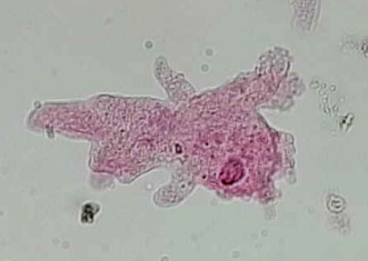 <p>Includes animals, fungi, and related protists. Amoebozoans!</p>