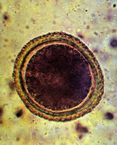 <p>What <strong>type of nematode egg</strong> is this?</p>