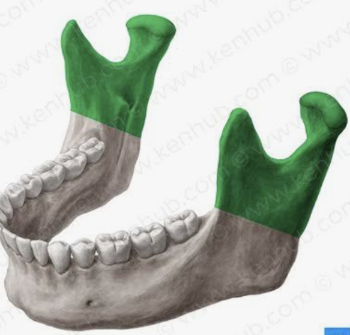 <p>What bone is this?</p>