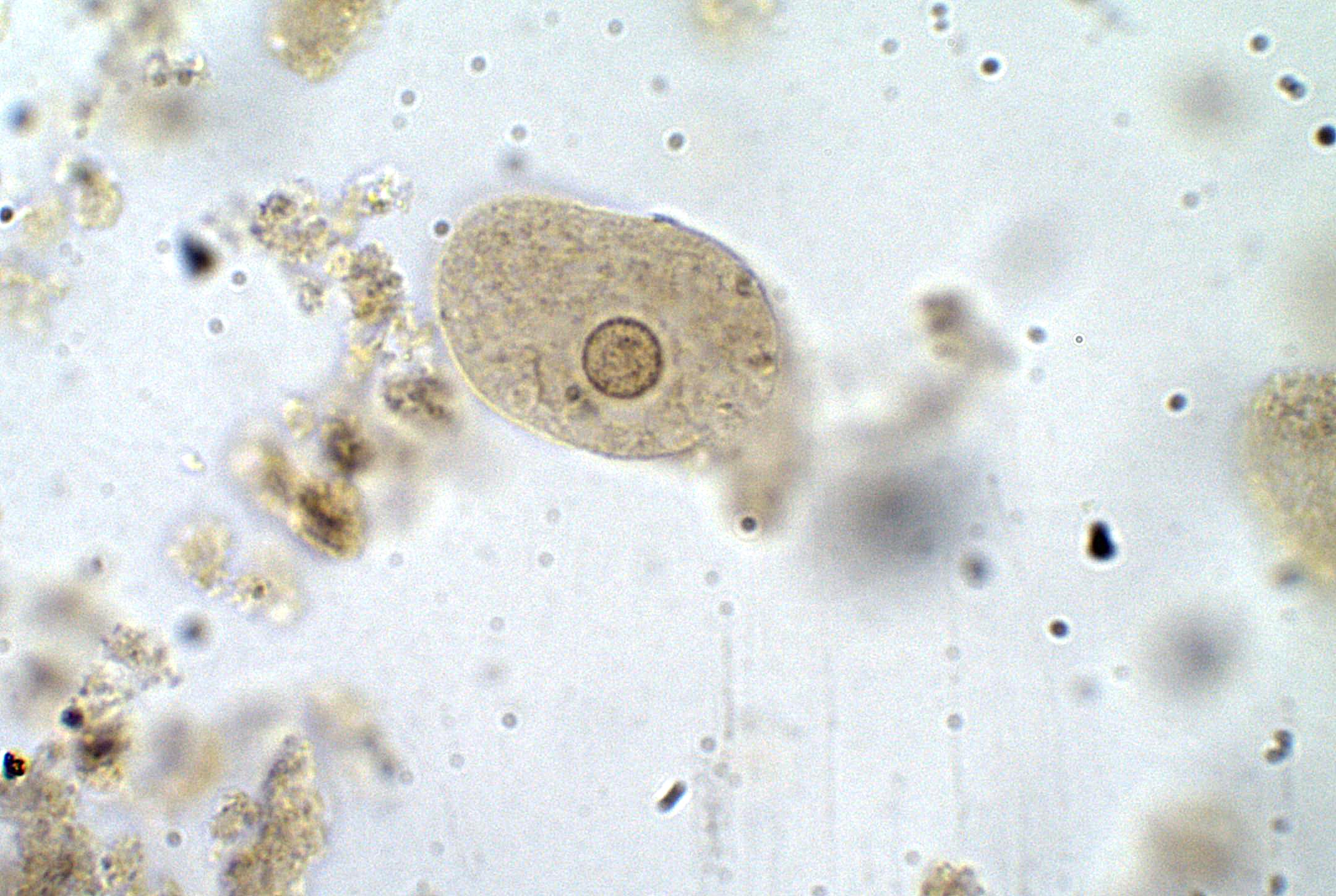 <p><span style="background-color: transparent;"><em>Entamoeba</em></span></p>
