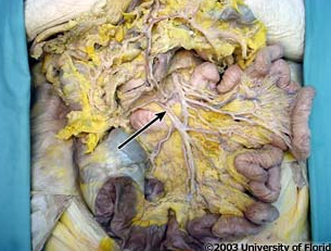 <p>what vein is being indicated to in the image?</p>