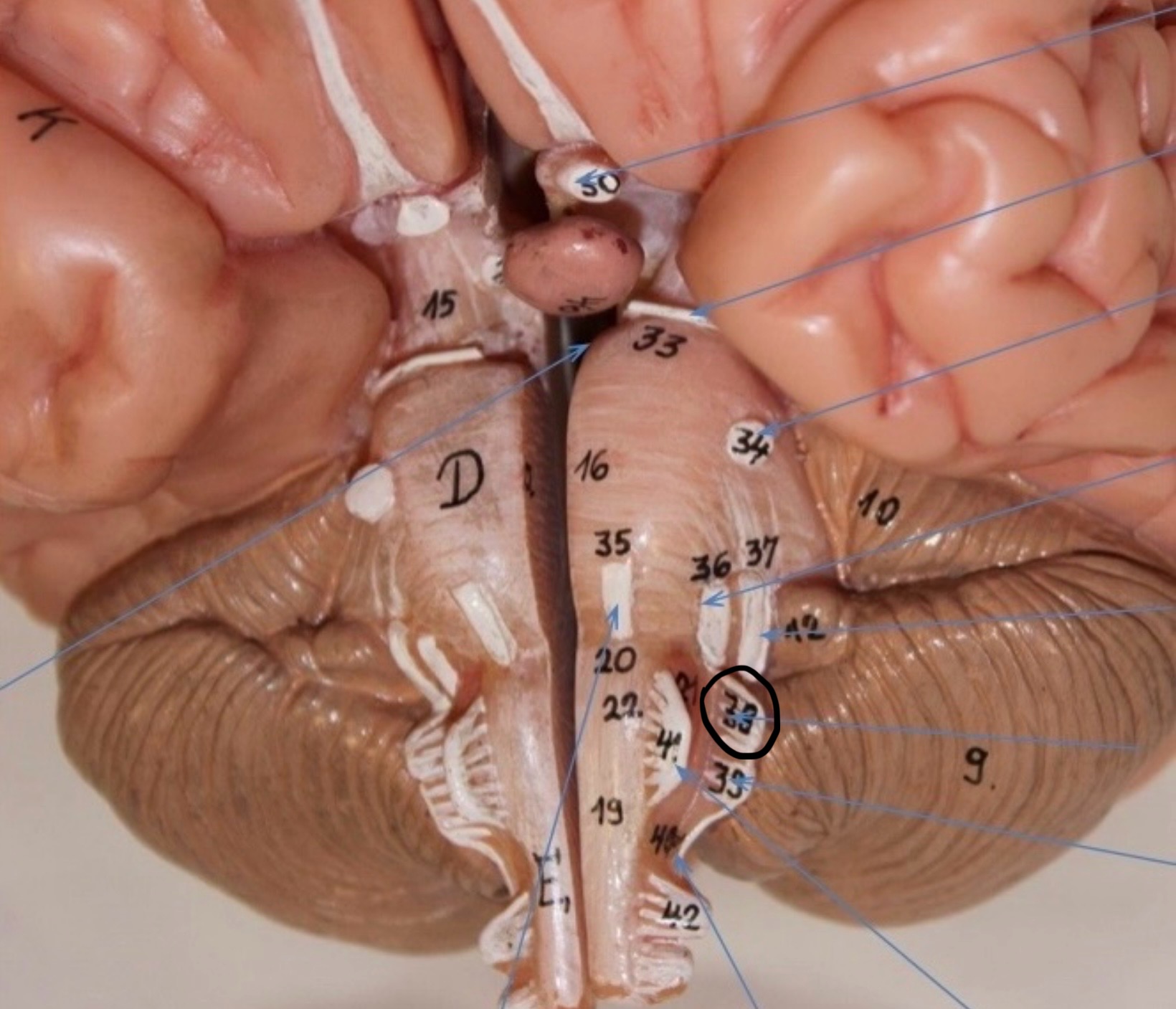 <p>Identify the circled area?</p>