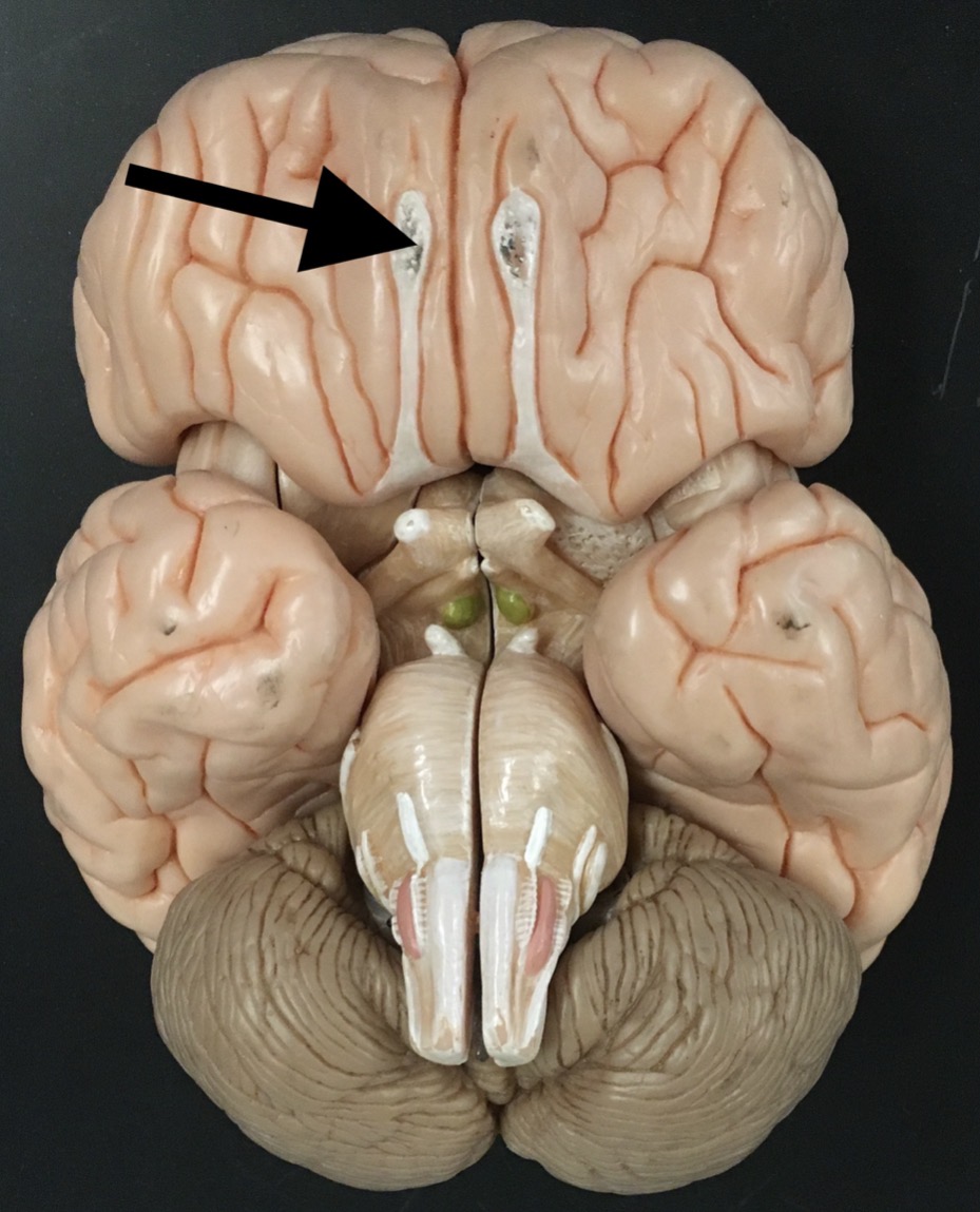 <p>What is the arrow pointing to?</p>