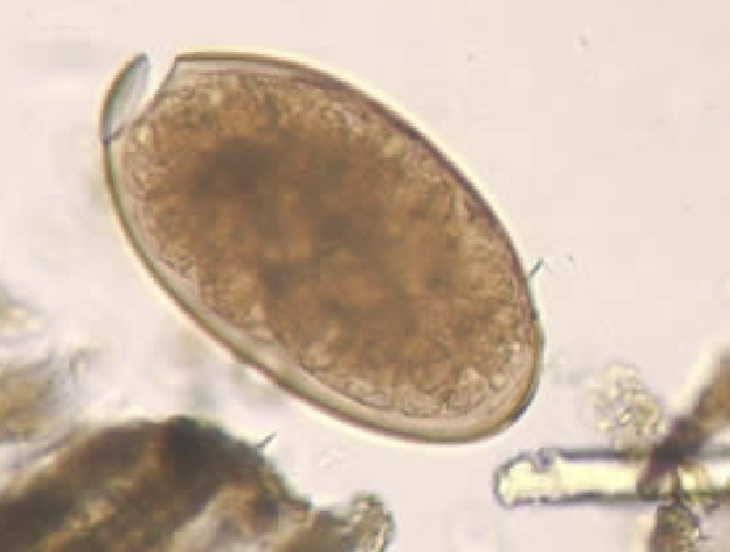<p>What helminth/fluke/parasitic worm is this?</p>